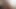Mature mother Alexis Golden takes BBC at her old butthole