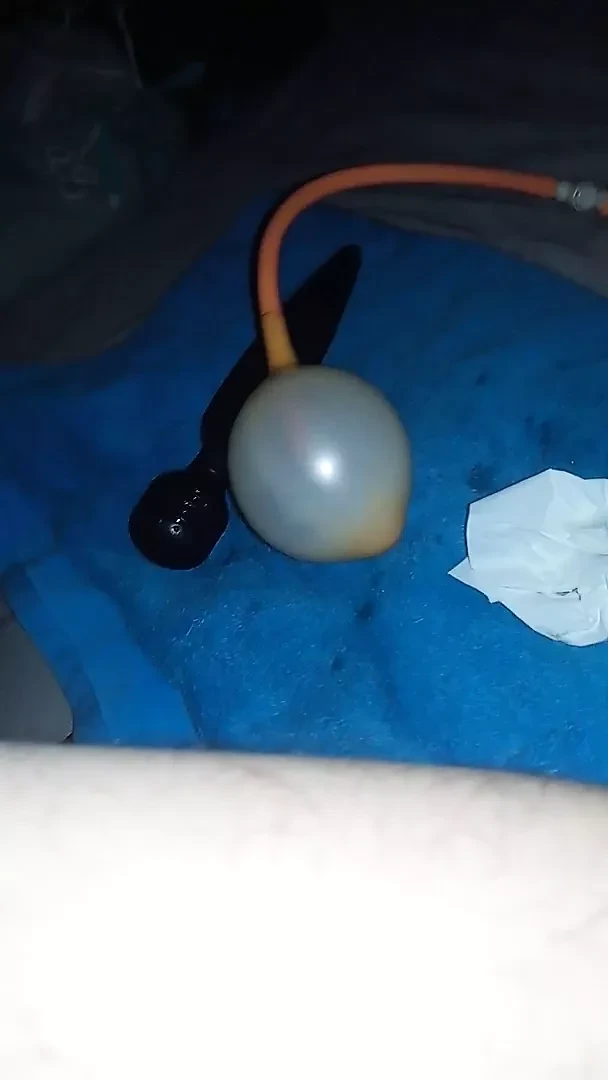 Anal seksim