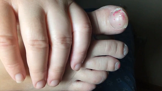 Ellie bacaklarına ve vücuduna krem sürüyor