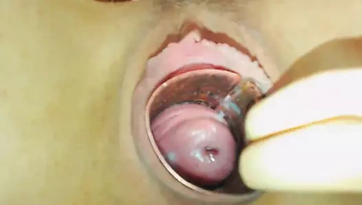 Sıcak serviks kamerada yakın çekim gösterisi - covid-88