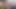 Aria Nicole, girlsgonegynocom'da doktor Tampa tarafından üretraya foley kateter sokmak için kartalı cerrahi masaya yayıyor