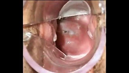 Speculum Cum