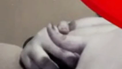 Biy sakit lh pepek syg