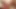 Hastalara anal seks yapmasına izin veren bir Fransız hemşire