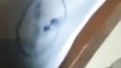 Putaanal yumruk sokma