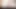 Problemler Üniversitesi - (pt 47) - dreamnow