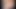 Bu civciv arabası bozuldu