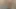 Amına boşalma fışkırtarak boşalma enjeksiyonu