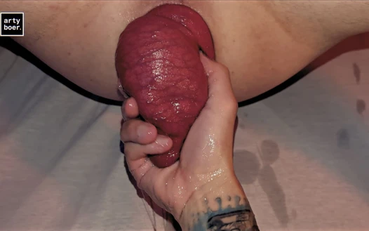 Arty Boer ve Prolapsiboy.