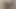 2025 dev kadın kıllı amcık
