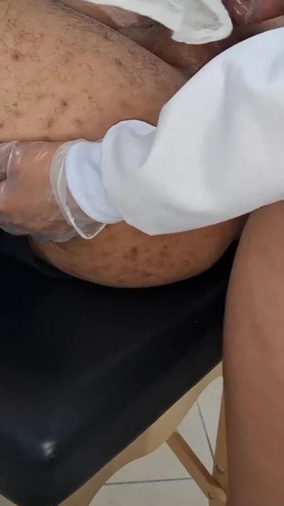 Hasta onu siken lezbiyen bir ürolog tarafından görülüyor. | Klip 2