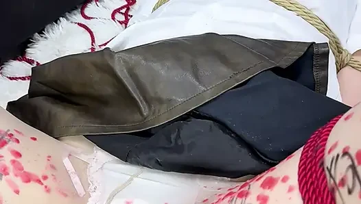 Damlama ağdası, anal kanca, m-leg