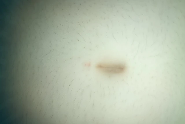 Мокрая кнопка живота