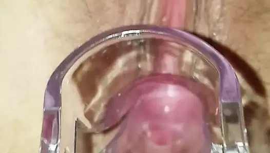 spekulum büyük klit ile eşimin kedi içine bakmak
