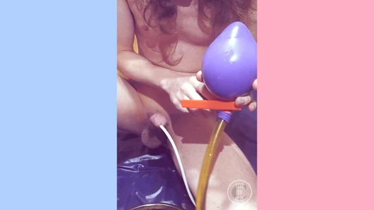 İdrar torbasında şişme 700 ml Balon