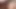 Hardx sulu eşek sarışının bbc anal enjeksiyonu