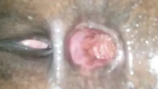 Gaped Jamaican Asshole PT.8