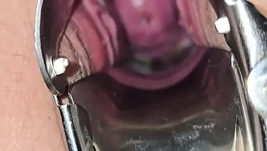 Orta yaşlı seksi kadın amını teftiş ediyor ve içine görmek için spekulum sokuyor