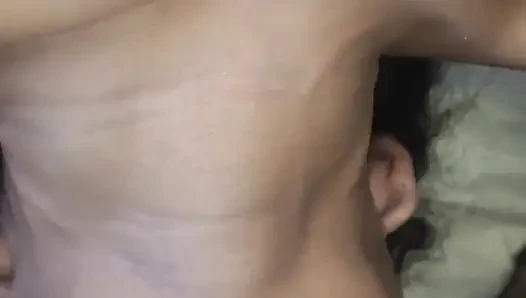 Şişkinlik ile gırtlağına kadar sidik ve süt 06/14/24