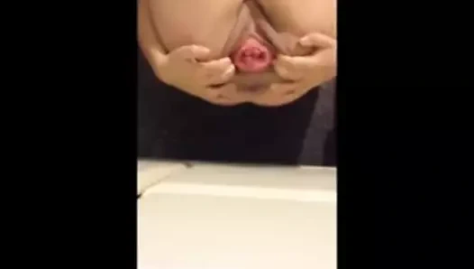 Cercix ve prolapsus amatör