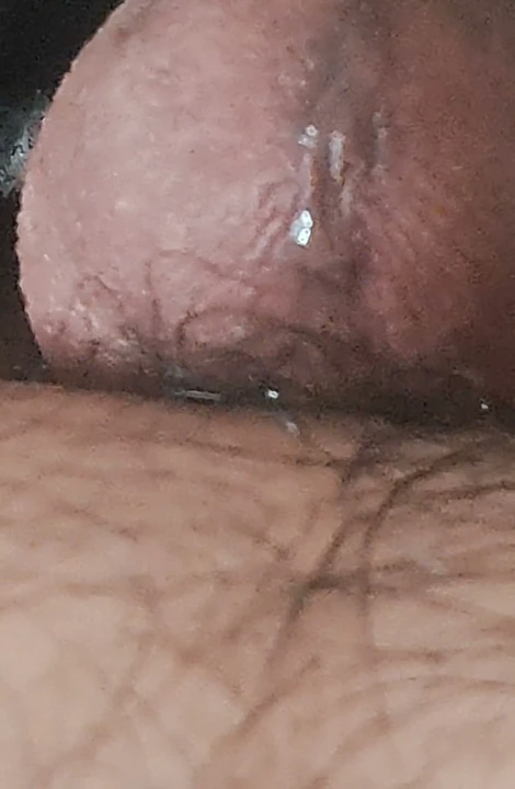 Penis ağlıyor