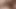 Mikropenis, minik horoz küçük sosis masajı