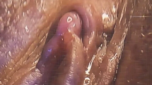 Tekrar - ve kenar ve kenar ve kenar...