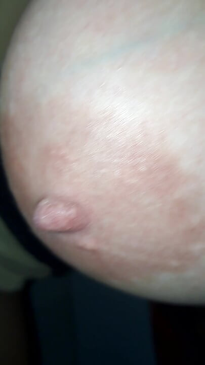Lanet