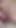 Big Clit Measurement & Comparison