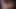 Beverly hills teaser 2