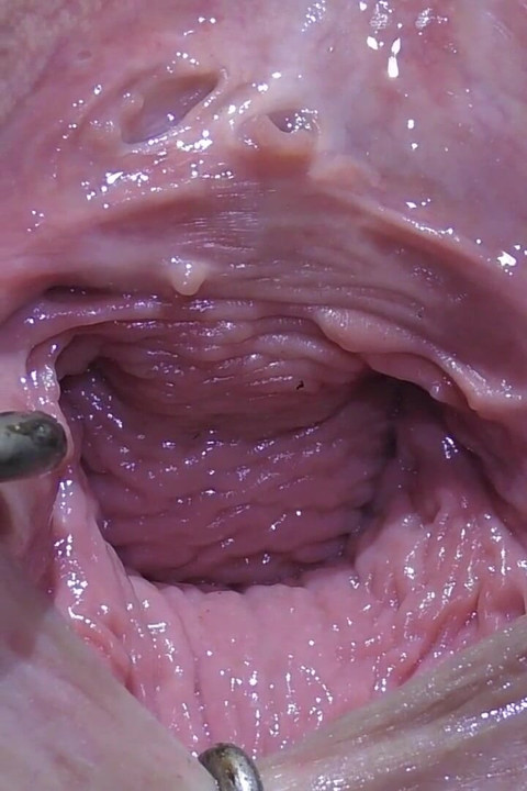 Wide Open