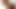 Beverly hills teaser 11