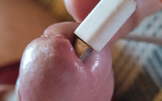 Penis Başının Içine Elektrik Şoku Uygulanması.