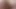 Abanoz anal ve dp