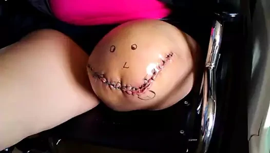 Frash ampute güdük