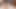 Tgirlpostop - foon videoda postop amına mastürbasyon yapıyor