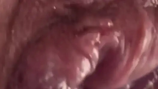 Aşırı anal vakum pompası eğitimi 2025