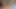 anal