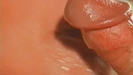 Klasik ateşli boşalma