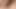 Fışkırtmalı mikro penis
