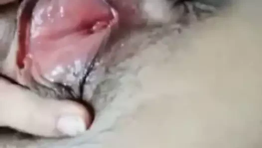 lanet ile yapay penis