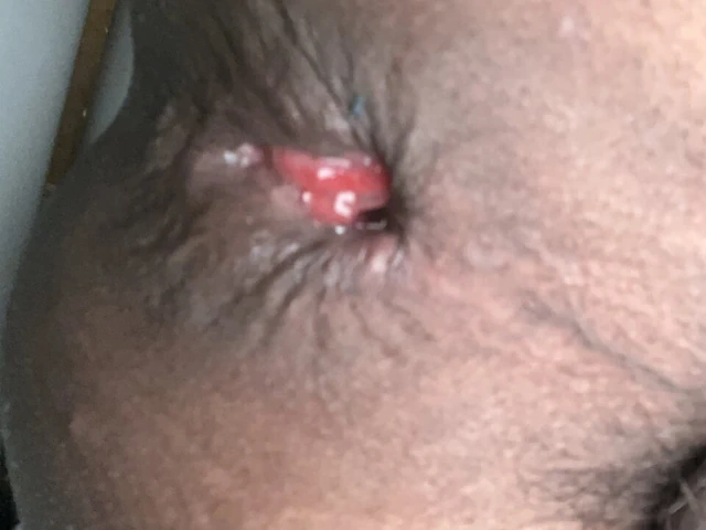 Üvey babam beni genişletti ve çok derine girdi