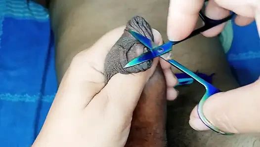 En iyi sünnet derisi sünnet rol yapma mastürbasyonu