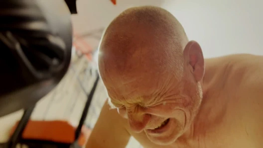 Kafa ağdası aşırı 491