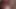 ben benim memeler ve benim şişkinlik