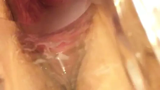 karısı spekulum içinde KEDİ serviks 5