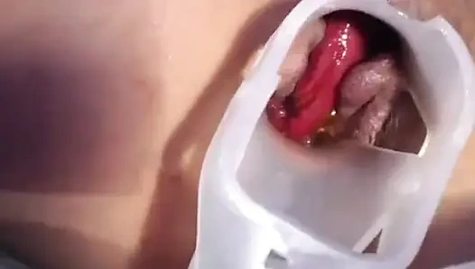 Anal speculum, amcık sikişi ve fışkırtma hd