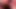 Anal fisted fuckhole, huge gaping, ruined asshole