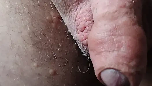 Çöküntünüşten kabarık sünnetik çok güzel!