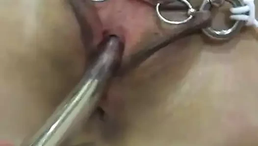 Peehole sondaj ve germe